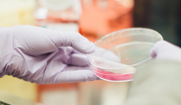 a person holding a medical sample